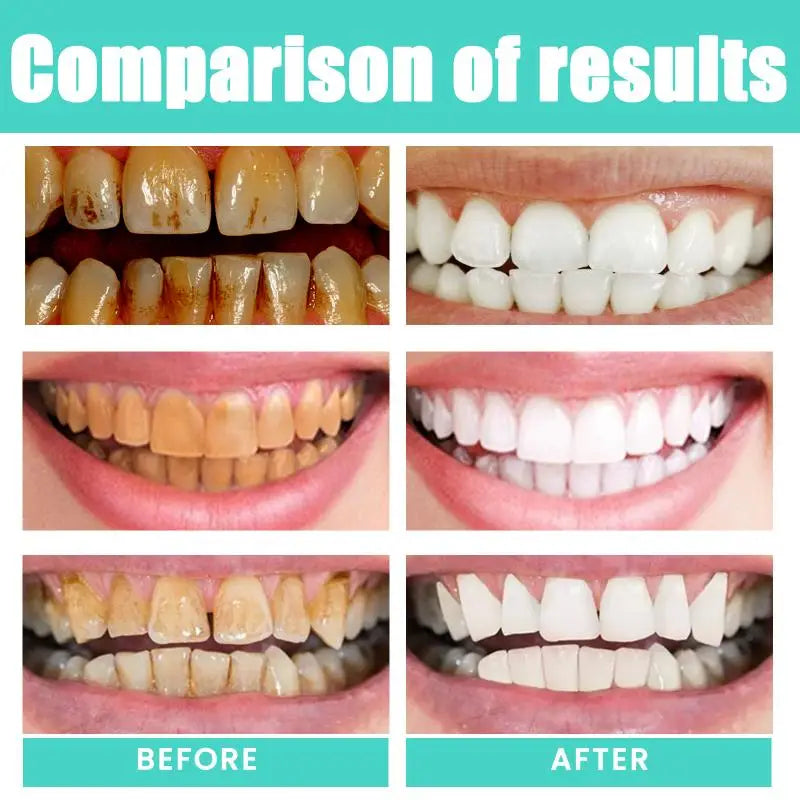 Kit Bain de Bouche Huile de Coco & Menthe ORALHOE + Gratte-Langue – Anti-Tartre, Dents Blanches, Haleine Fraîche