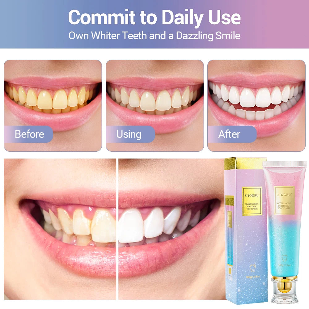 Dentifrice blanchissant à la niacinamide